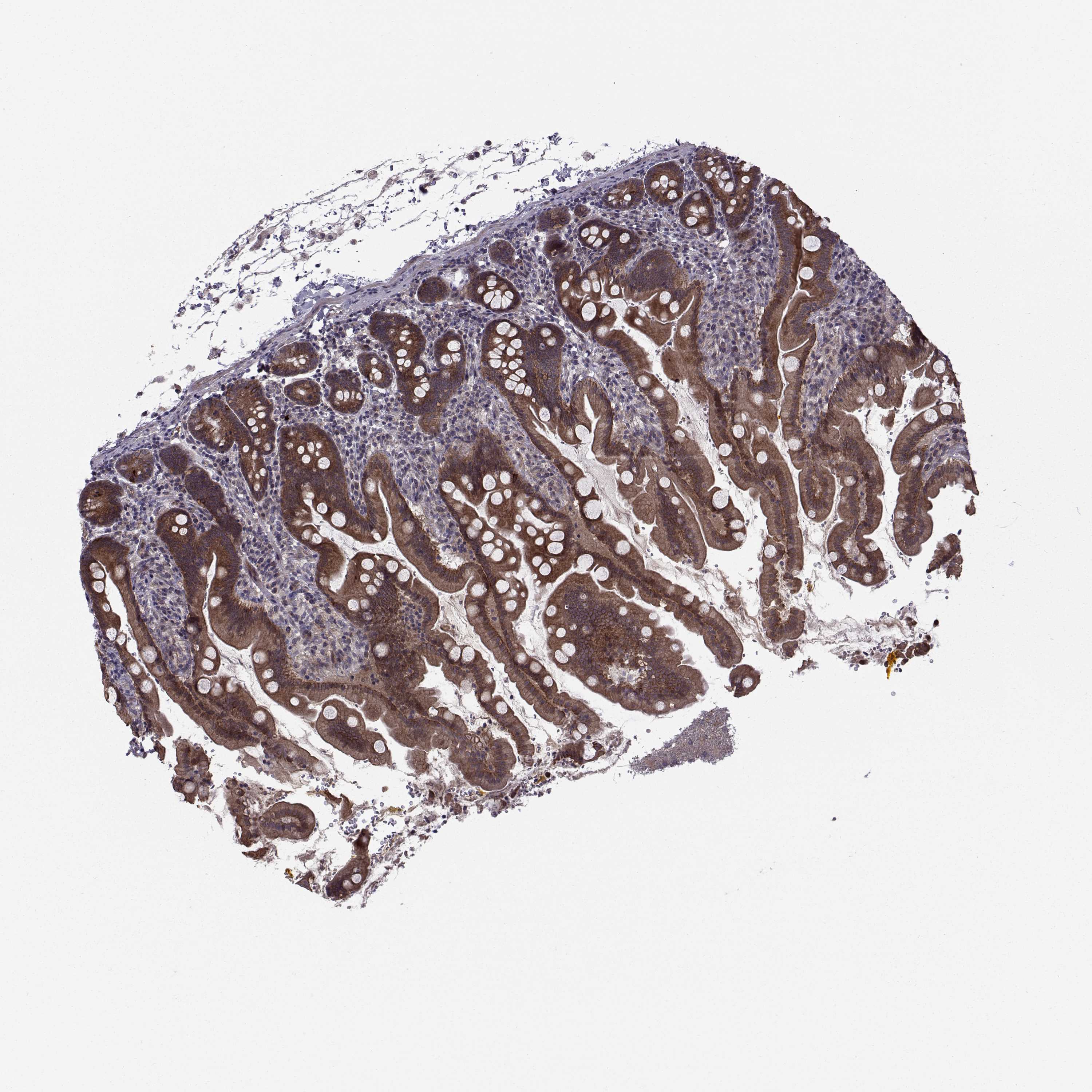 Tissue expression of APC Staining in small intestine The Human