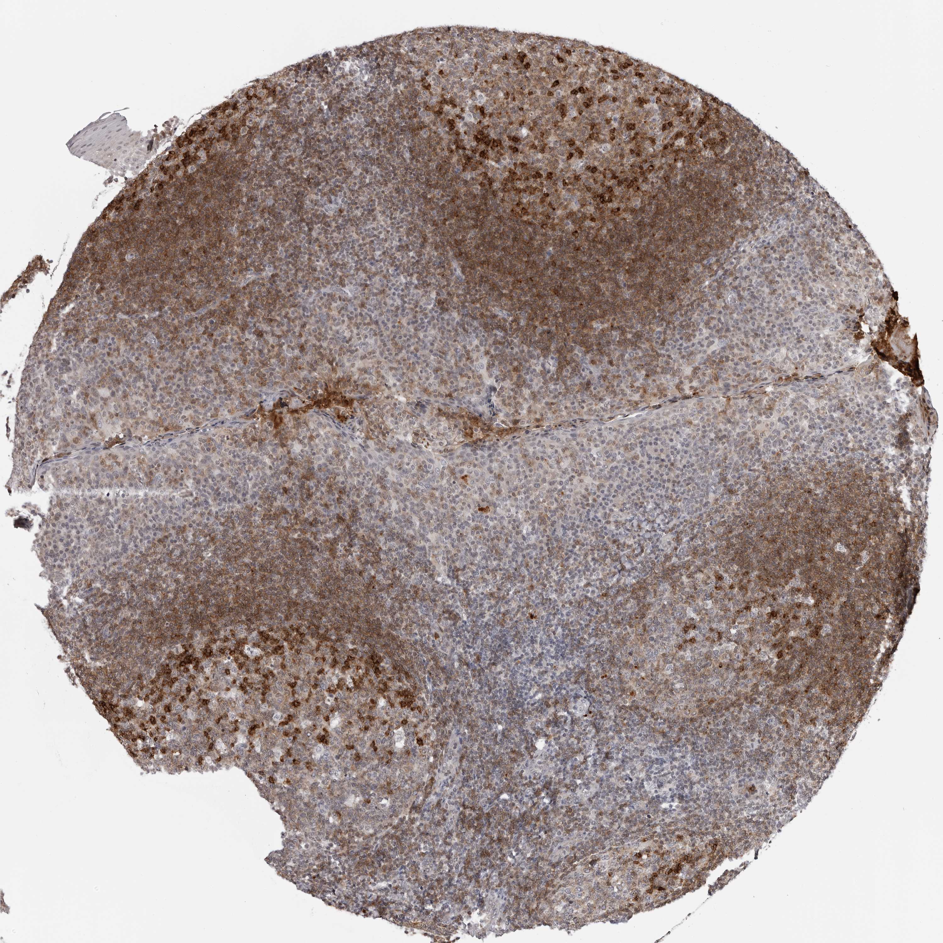Tissue expression of CXCR5 Staining in tonsil The Human Protein Atlas