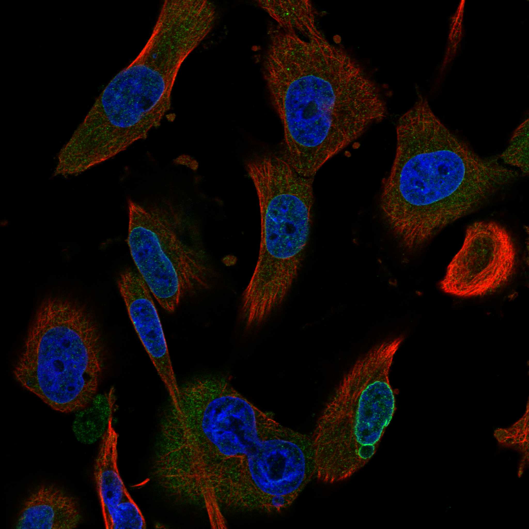 Cell atlas - GPR183 - The Human Protein Atlas