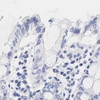 HPA IHC Colon — AR