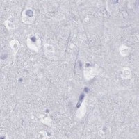 HPA IHC Cerebral cortex — AR
