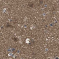 HPA IHC Cerebral cortex — ARHGDIA