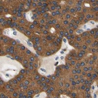 HPA IHC Parathyroid gland — PLA2G4A