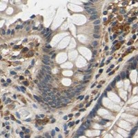 HPA IHC Colon — PLA2G4A