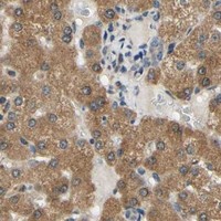 HPA IHC Liver — PLA2G4A