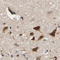 HPA IHC Cerebral cortex — PLA2G4A
