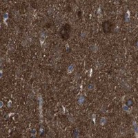 HPA IHC Cerebral cortex — HK1