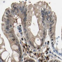 HPA IHC Colon — PGK1