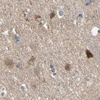 HPA IHC Cerebral cortex — PGK1