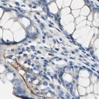HPA IHC Colon — COL6A3