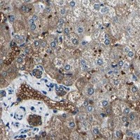 HPA IHC Liver — CA2