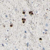 HPA IHC Cerebral cortex — CA2