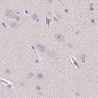 HPA IHC Cerebral cortex — POLR3G