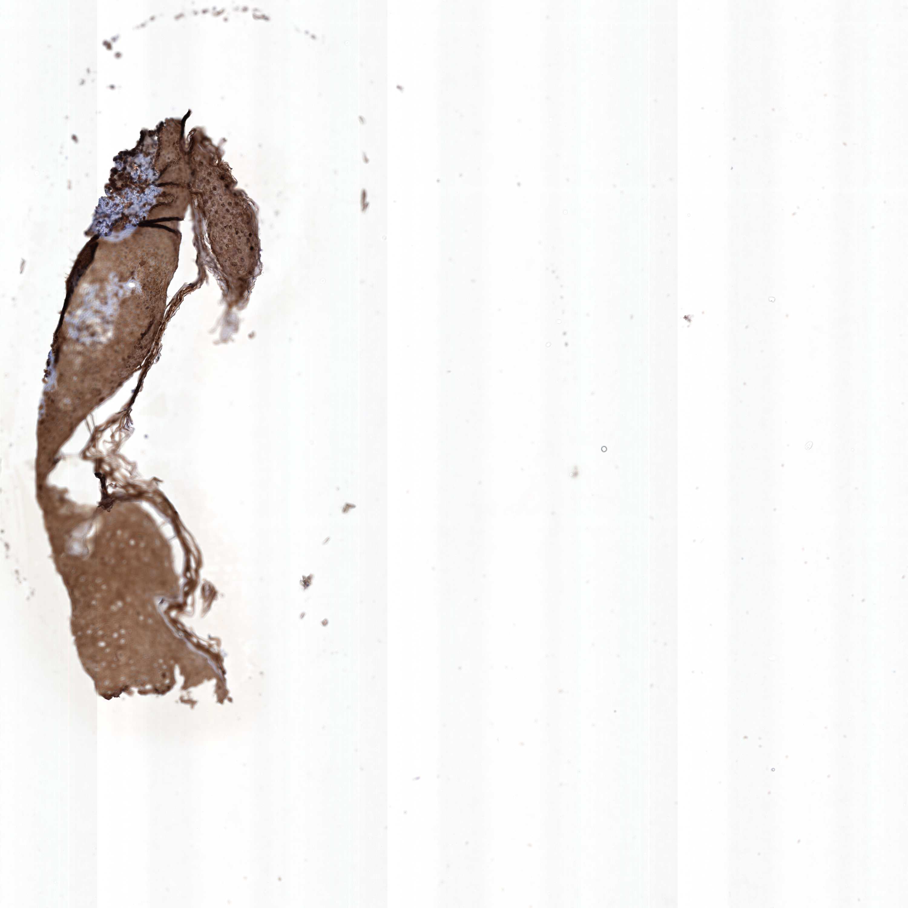 Proteine Atlas Rat - Syngap1 Antibody Immunohistochemistry ...