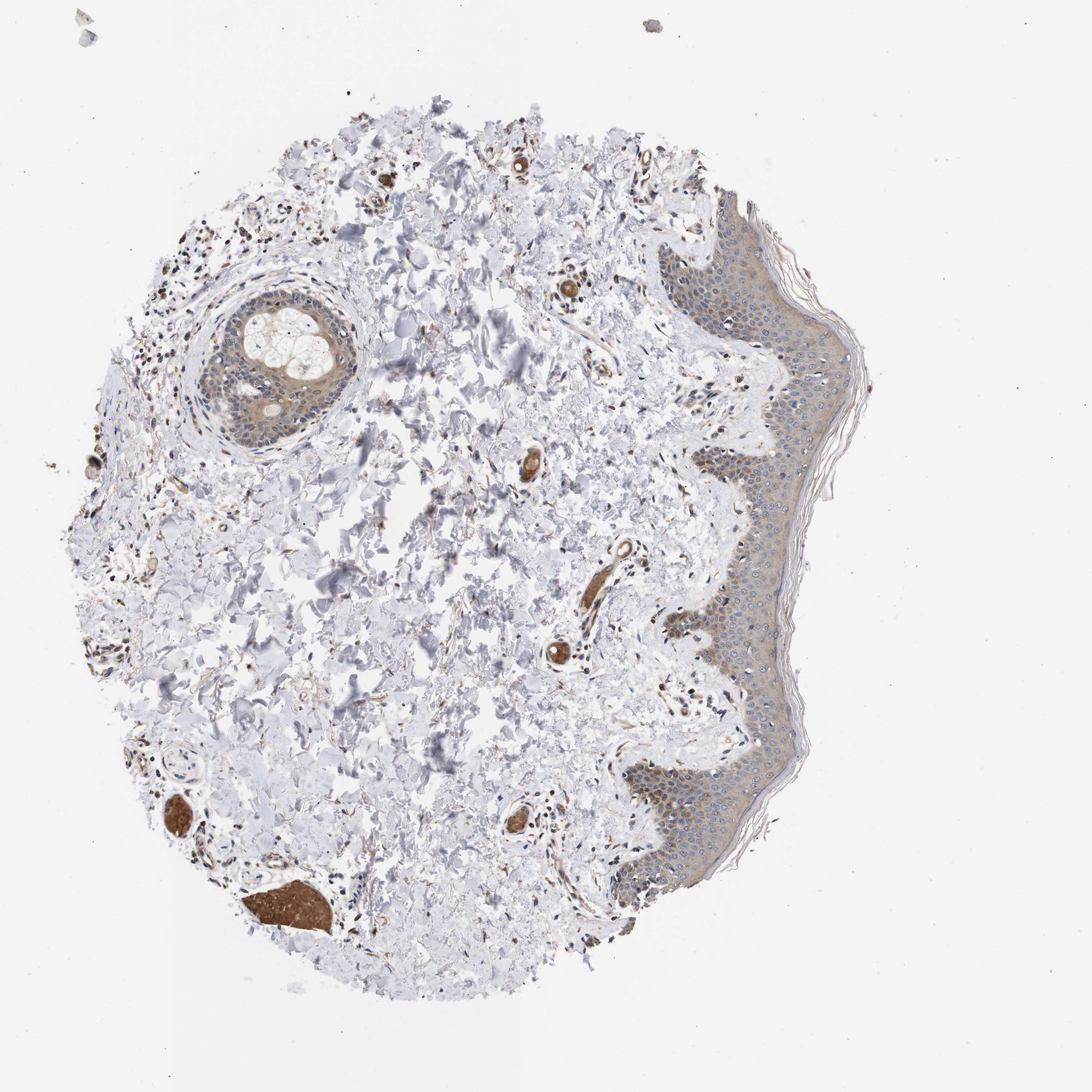 Tissue expression of DDR1 Staining in skin The Human Protein Atlas