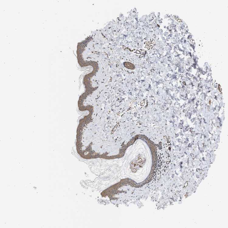 Tissue expression of DDR1 Staining in skin The Human Protein Atlas
