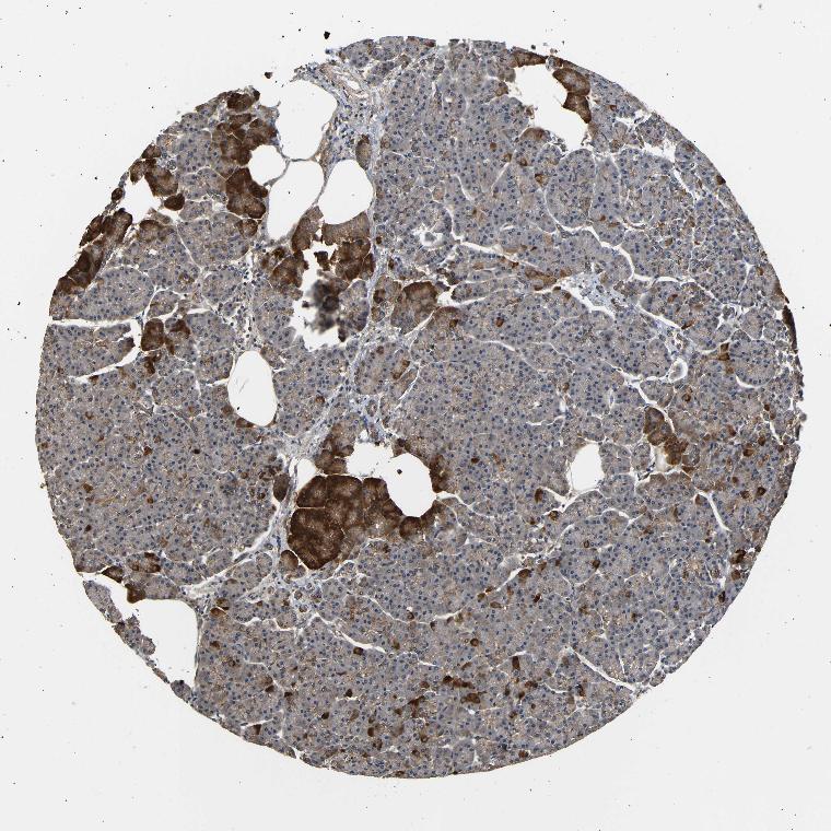 Tissue expression of DDR1 Staining in pancreas The Human Protein Atlas