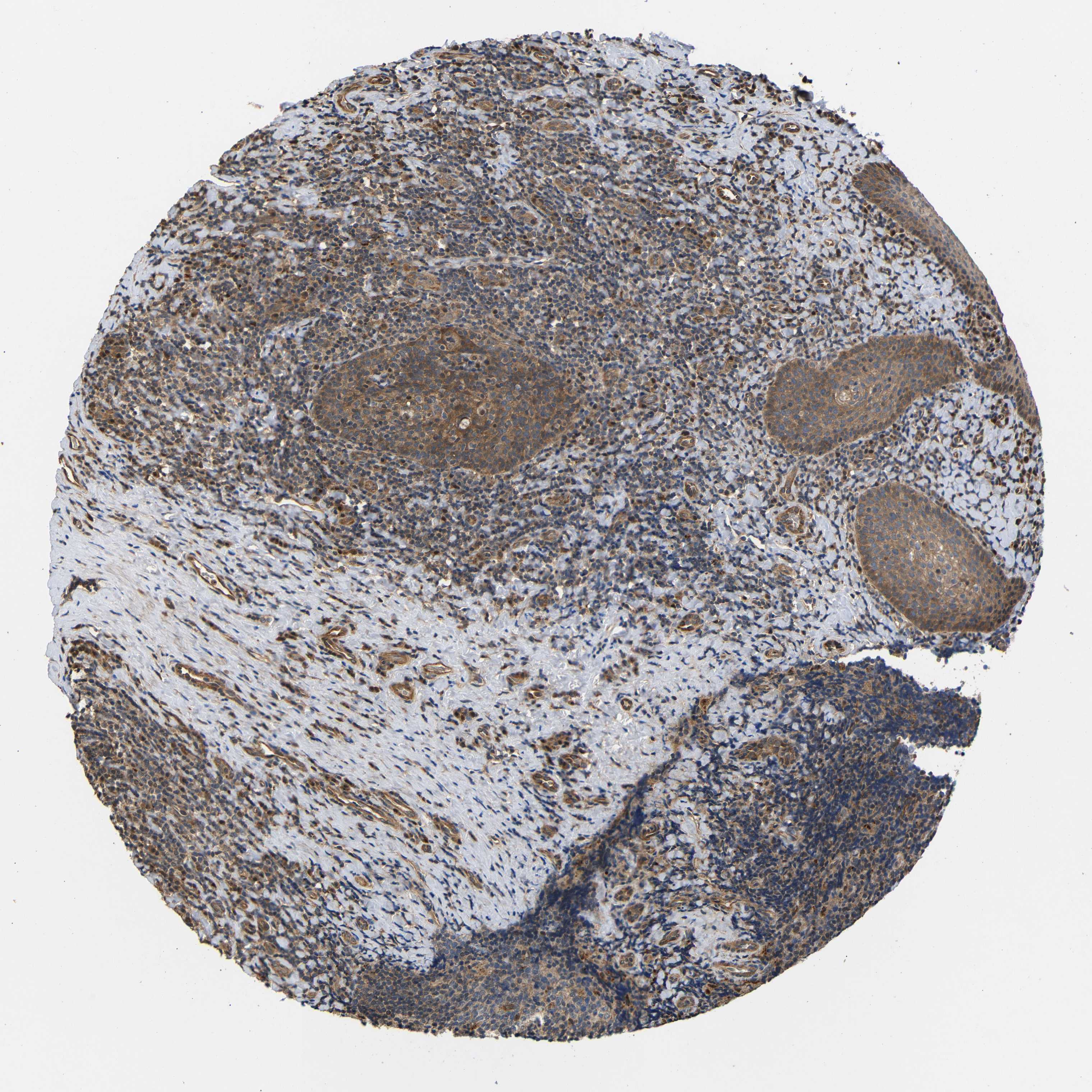 Tissue expression of DDR1 Staining in tonsil The Human Protein Atlas