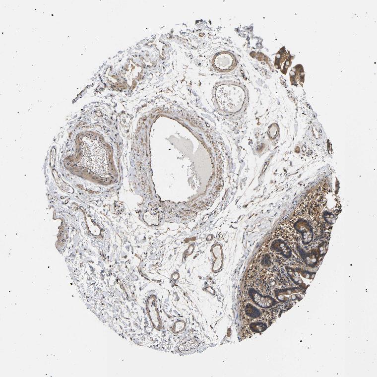 Tissue expression of DDR1 Staining in colon The Human Protein Atlas