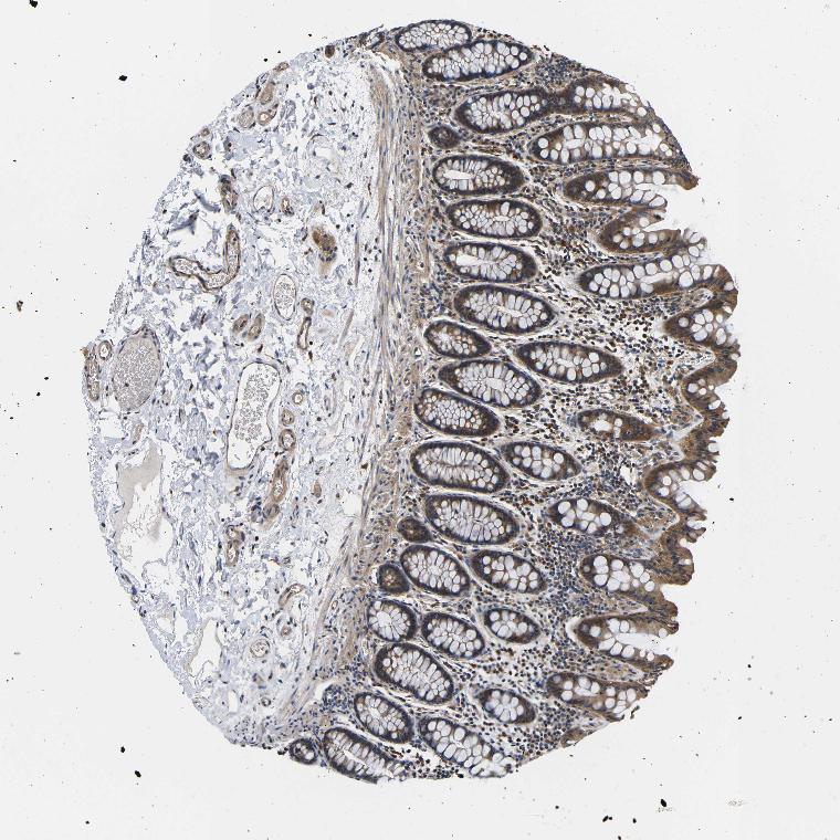 Tissue expression of DDR1 Staining in colon The Human Protein Atlas