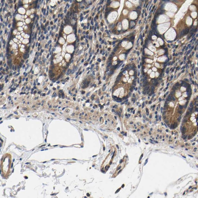 DDR1 Antibodies The Human Protein Atlas