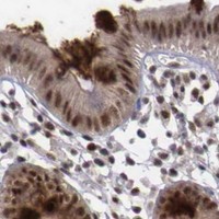 HPA IHC Colon — ATM