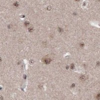 HPA IHC Cerebral cortex — ATM