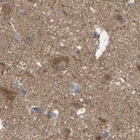 HPA IHC Cerebral cortex — ACOT8