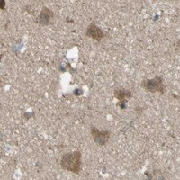 HPA IHC Cerebral cortex — YWHAQ