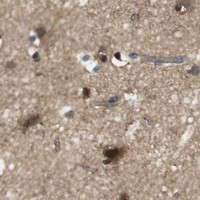 HPA IHC Cerebral cortex — RIPK1