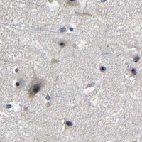 HPA IHC Cerebral cortex — MYC