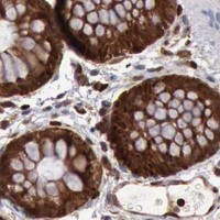 HPA IHC Colon — PDCD4