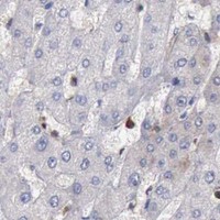 HPA IHC Liver — PDCD4