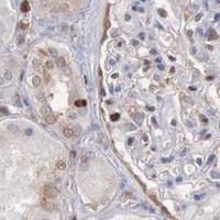 HPA IHC Kidney — PDCD4