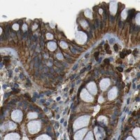 HPA IHC Colon — EPHA7