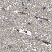 HPA IHC Cerebral cortex — EPHA7