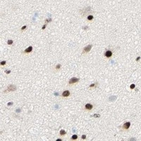 HPA IHC Cerebral cortex — WTAP