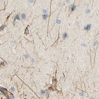 HPA IHC Cerebral cortex — KIF11