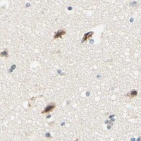 HPA IHC Cerebral cortex — TAOK2