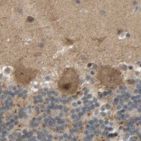 HPA IHC Cerebellum — ALK