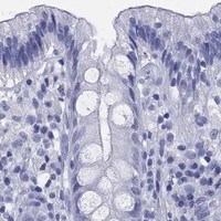 HPA IHC Colon — ATP1B2