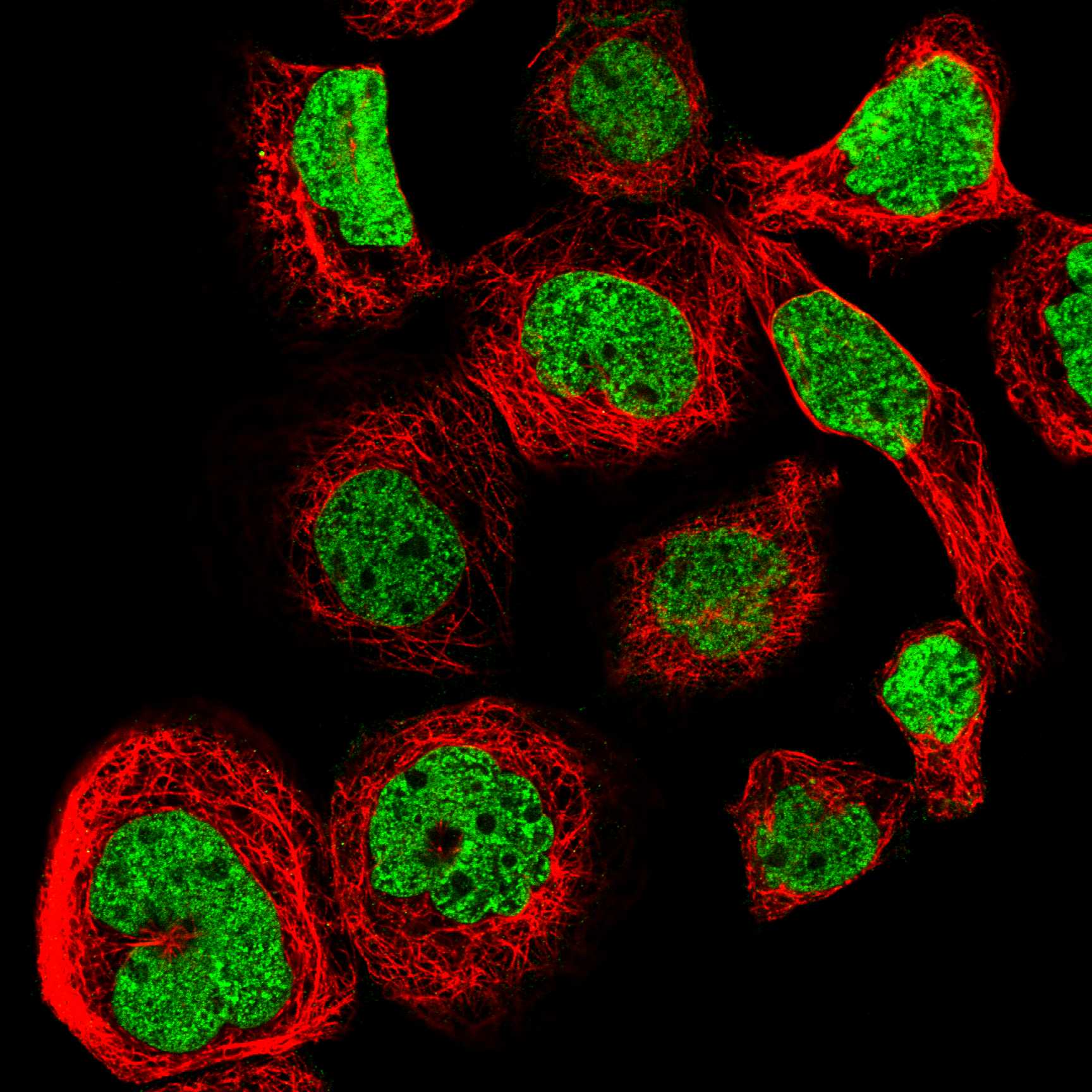 Cell atlas L1CAM The Human Protein Atlas
