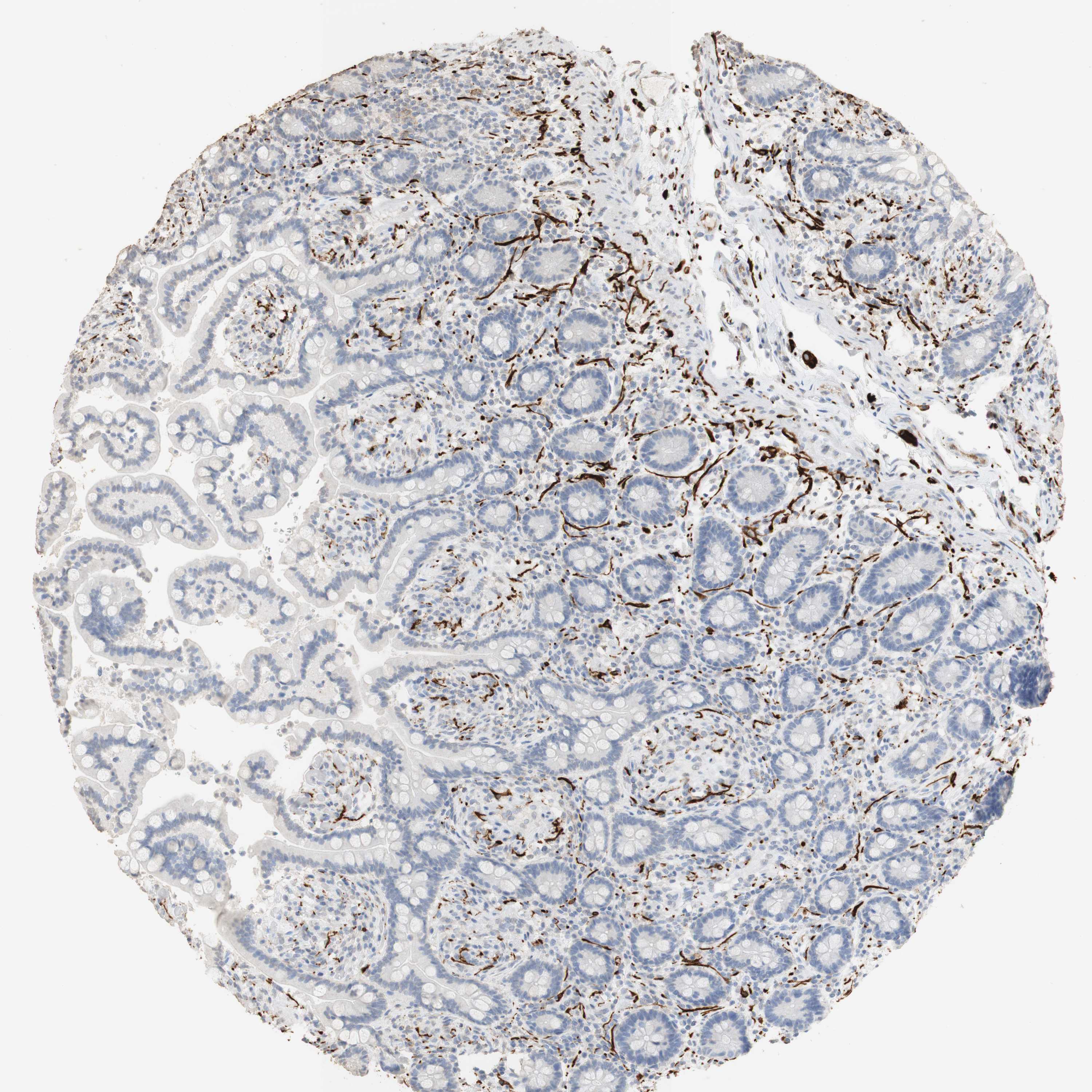 Tissue expression of L1CAM Staining in colon The Human Protein Atlas
