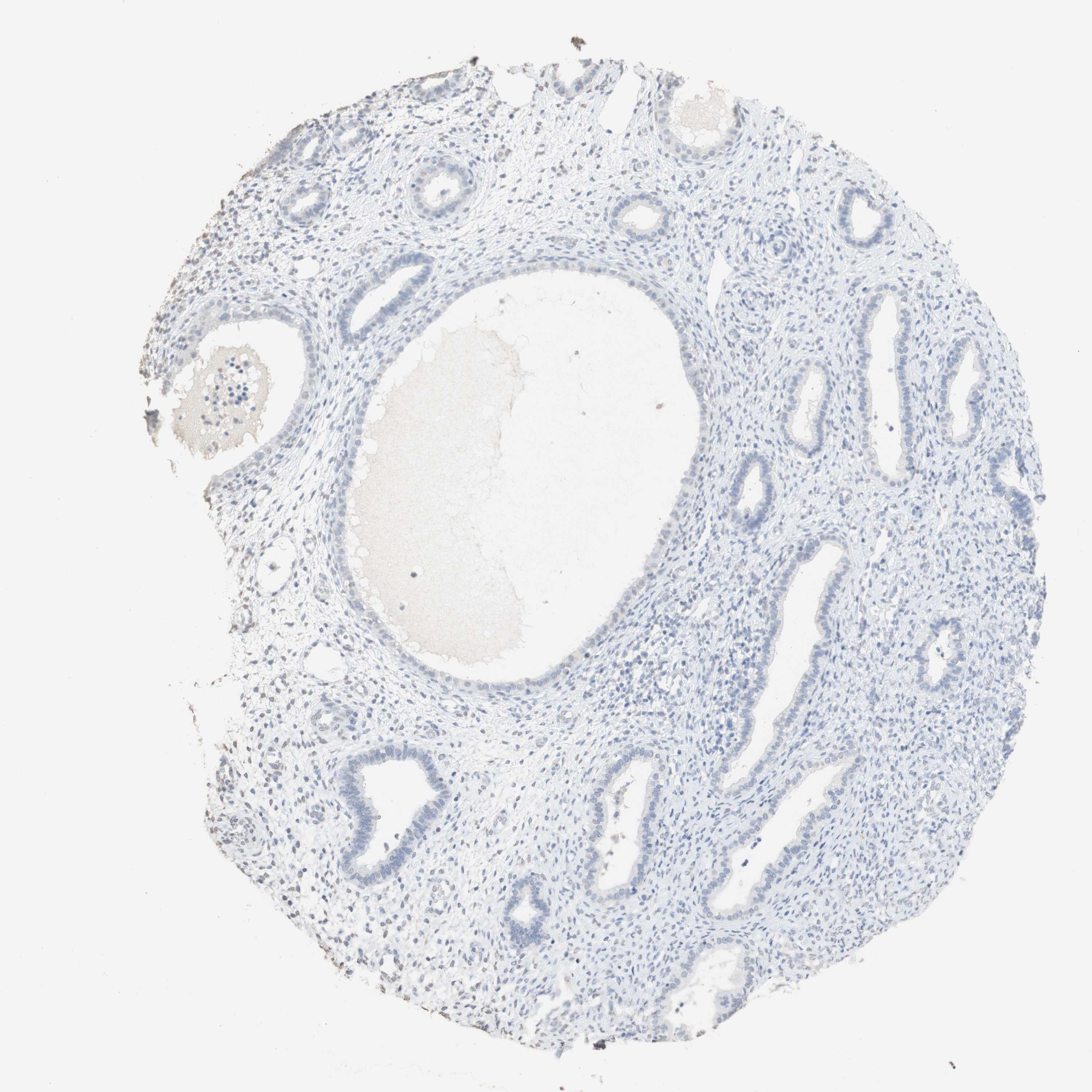 Tissue expression of L1CAM Staining in endometrium The Human