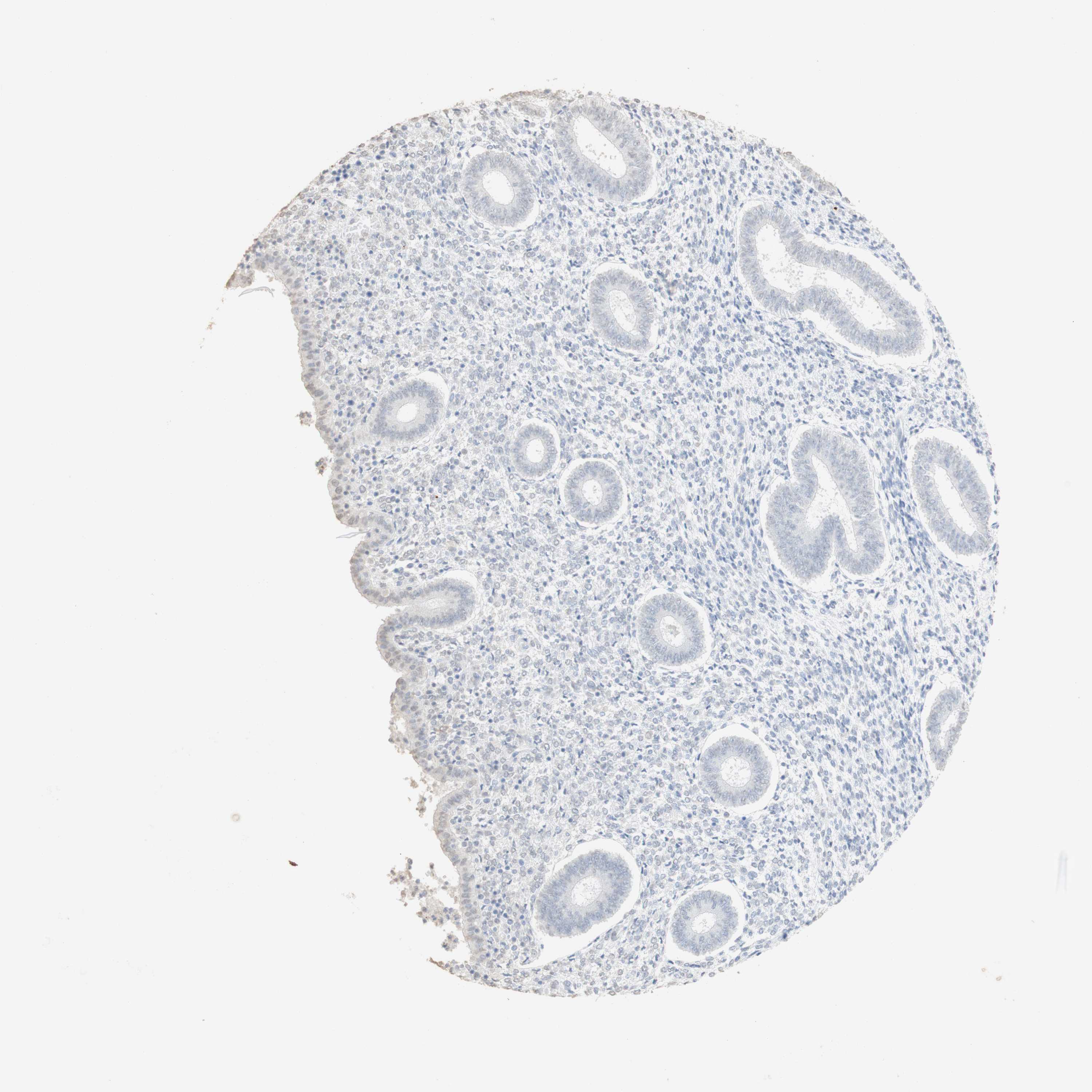 Tissue expression of L1CAM Staining in endometrium The Human