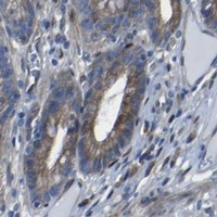 HPA IHC Colon — LRRN1