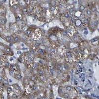 HPA IHC Liver — LRRN1