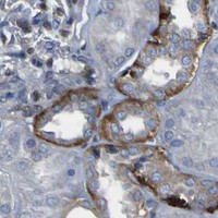 HPA IHC Kidney — LRRN1