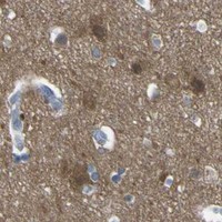 HPA IHC Cerebral cortex — LRRN1