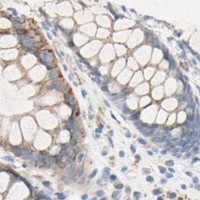 HPA IHC Colon — TMIGD2